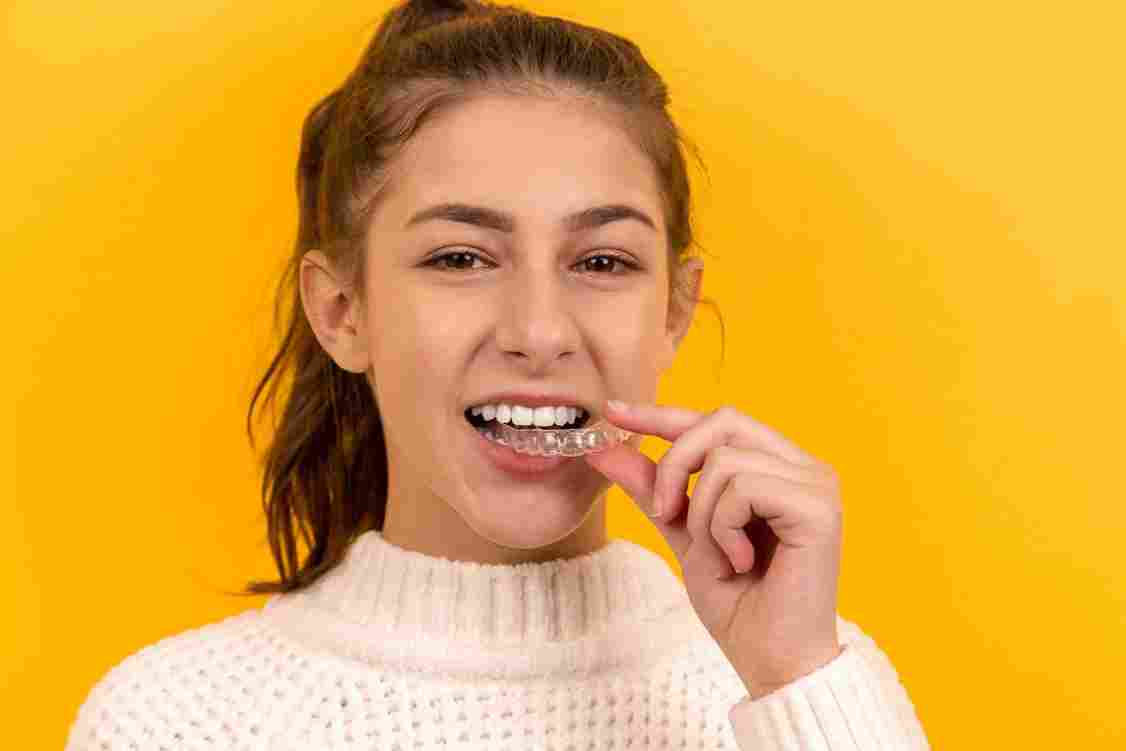 ortodoncia invisble para adolescentes