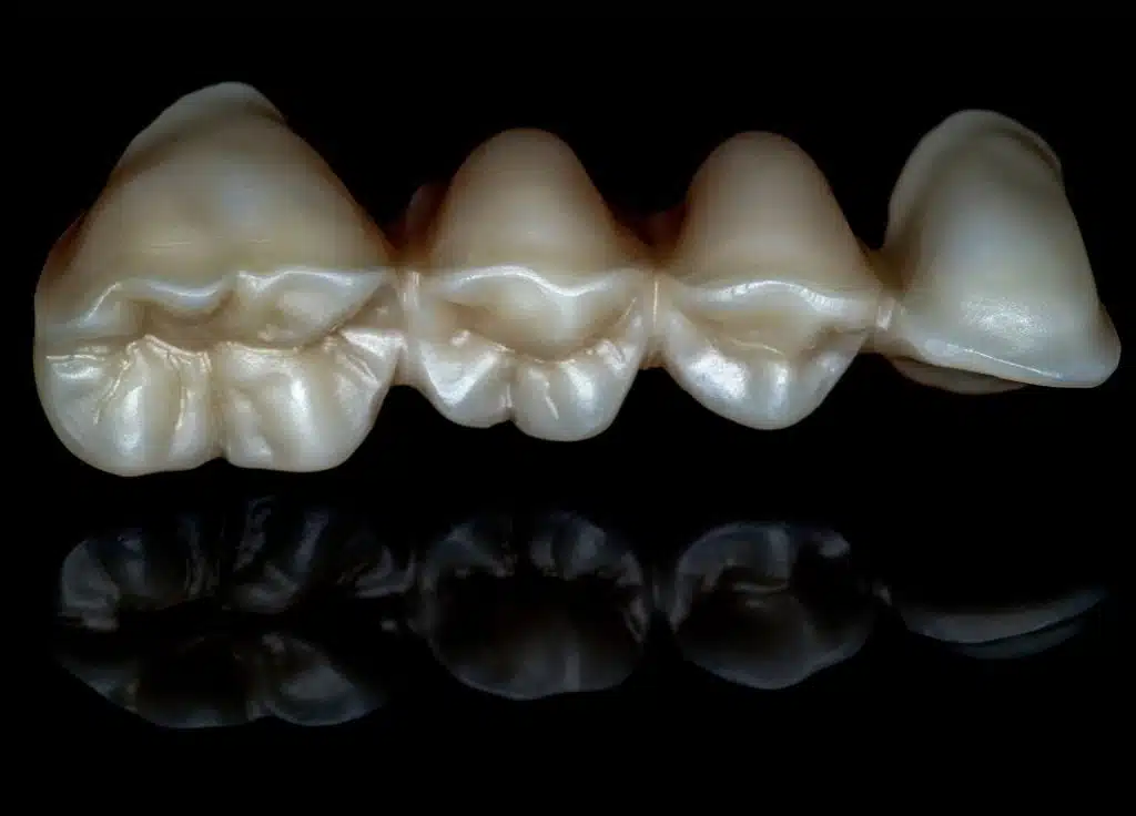 Odontología digital - Resultado y seguimiento