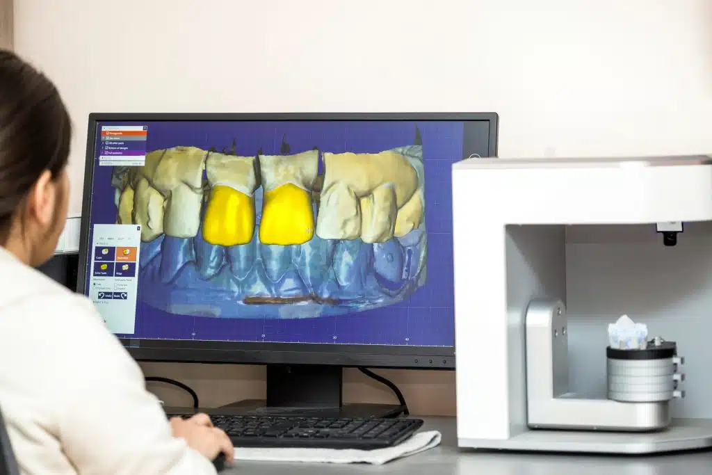 Odontología digital - Planificación 3D