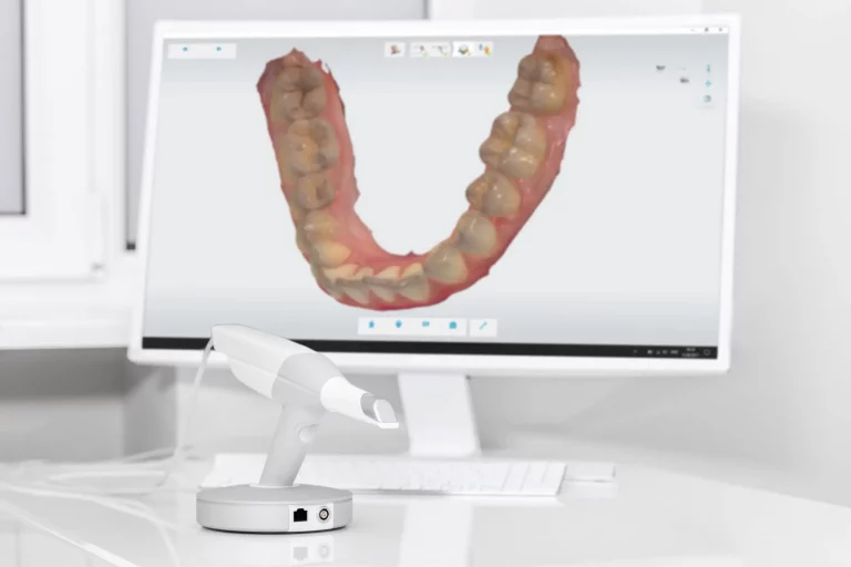 Planificación digital y escaneado intraoral: enfoque conservador y preciso