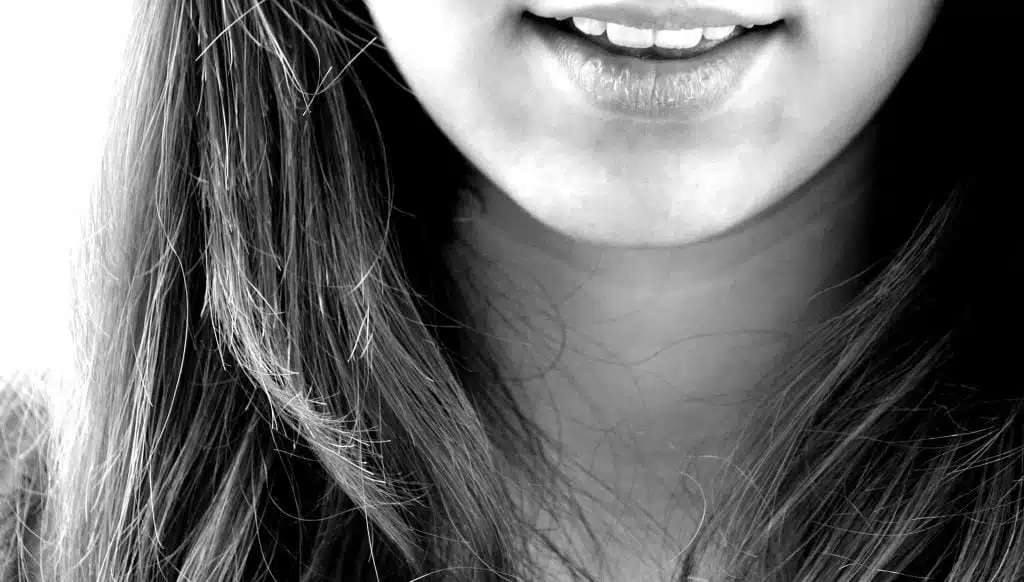 Sonrisa adolescente tras tratamiento de ortodoncia