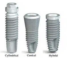 diferentes formas de implantes