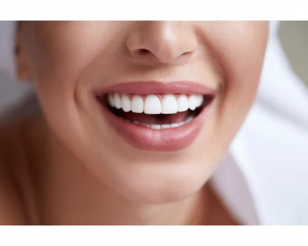 Kit de blanqueamiento dental con férulas para usar en casa