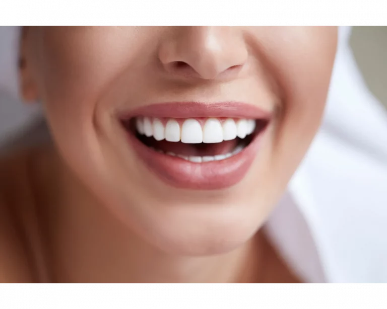 Carillas dentales y estética dental en Clínica Dental Nin Sant Gervasi