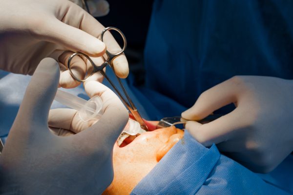 Cirugía oral en Clínica Dental Nin Barcelona Sant Gervasi