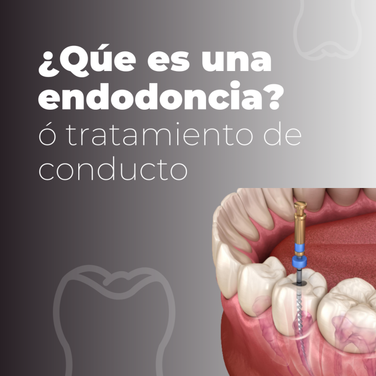 ENDODONCIA