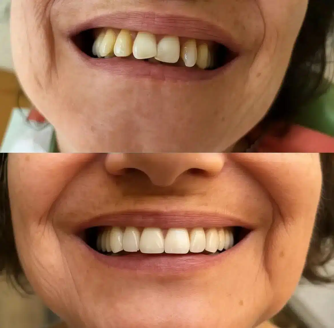 Resultado clínico: antes y después