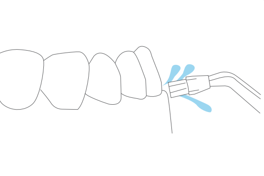 Punta Plaque Brush Turewell para implantes coronas y puentes